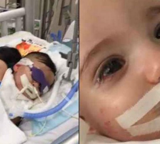 Bebê em coma abre os olhos antes de aparelhos serem desligados; veja