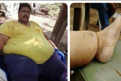 Morre o homem mais gordo do mundo