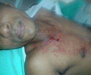 Homem é baleado no peito por indivíduos em motocicleta