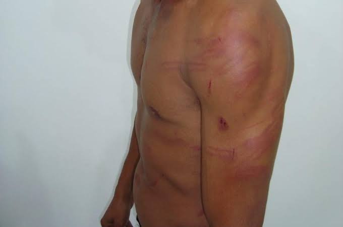 CALADINHO: Mulher é presa após agredir marido e sogro na zona Sul