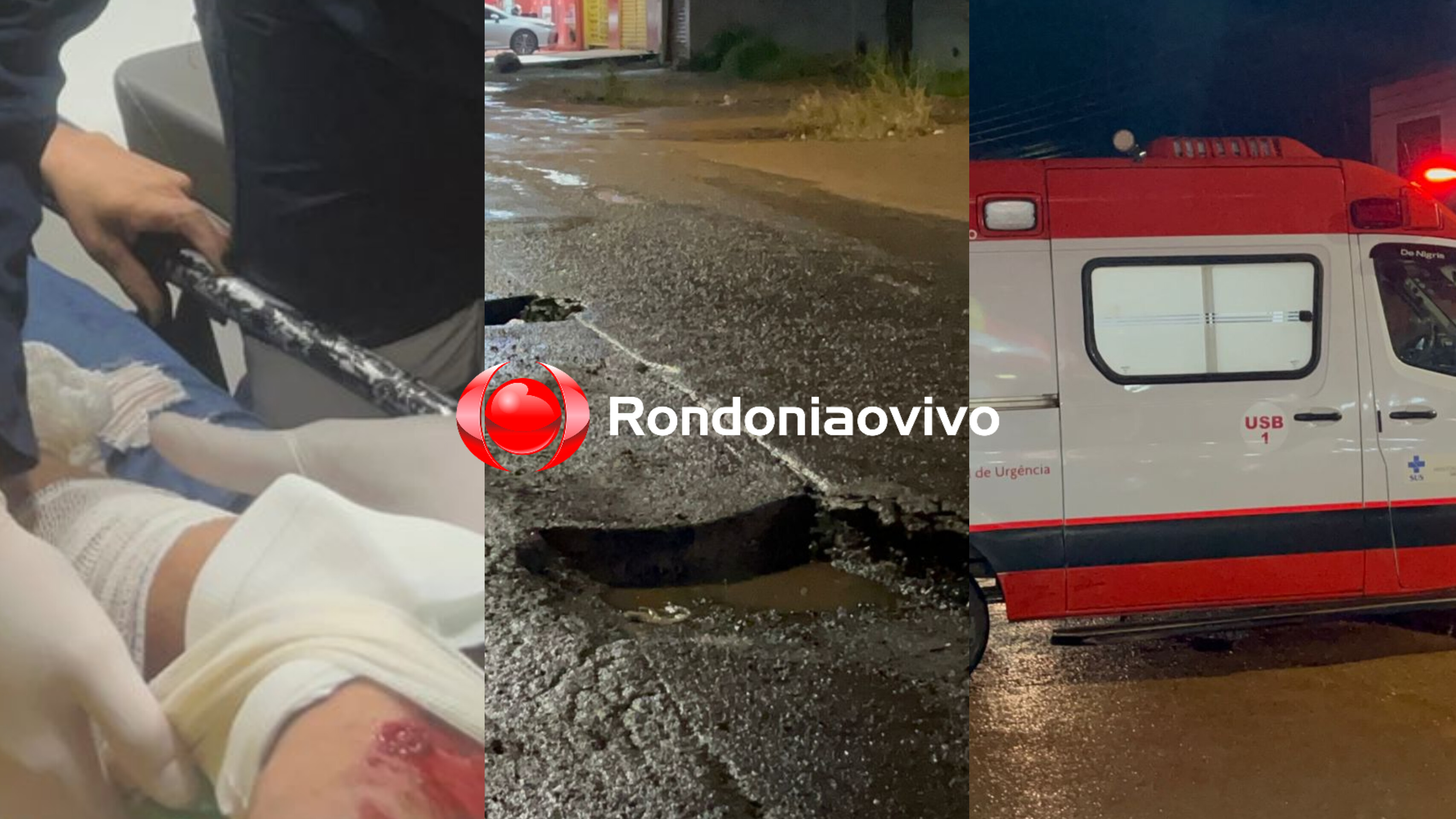 URGENTE: Mãe e filha sofrem grave acidente após queda de moto em buraco 