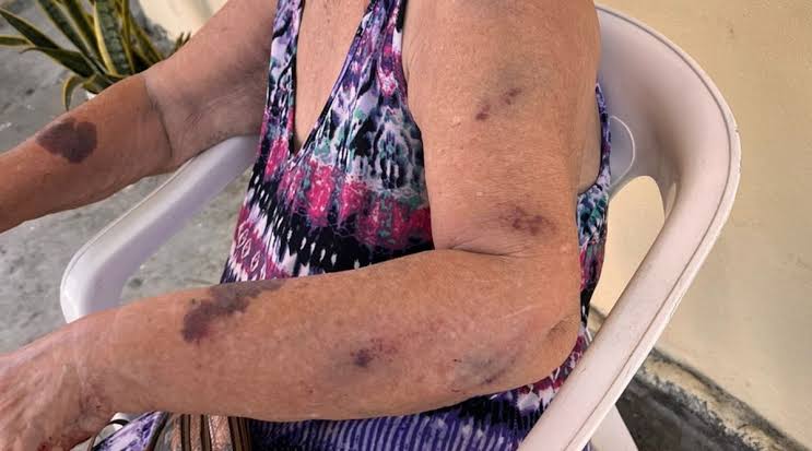 COVARDIA: Idosa de 68 anos é agredida pelo filho alucinado 