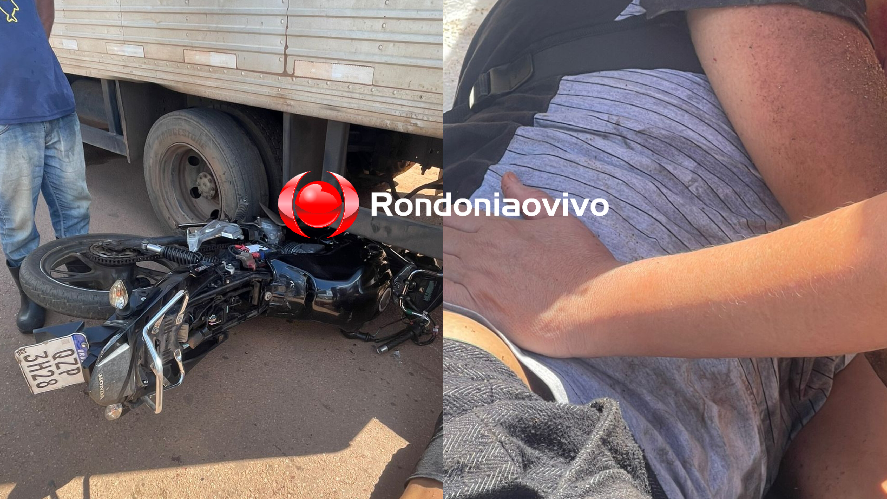 NA AMAZONAS : Adolescente fica inconsciente após acidente envolvendo caminhão baú 