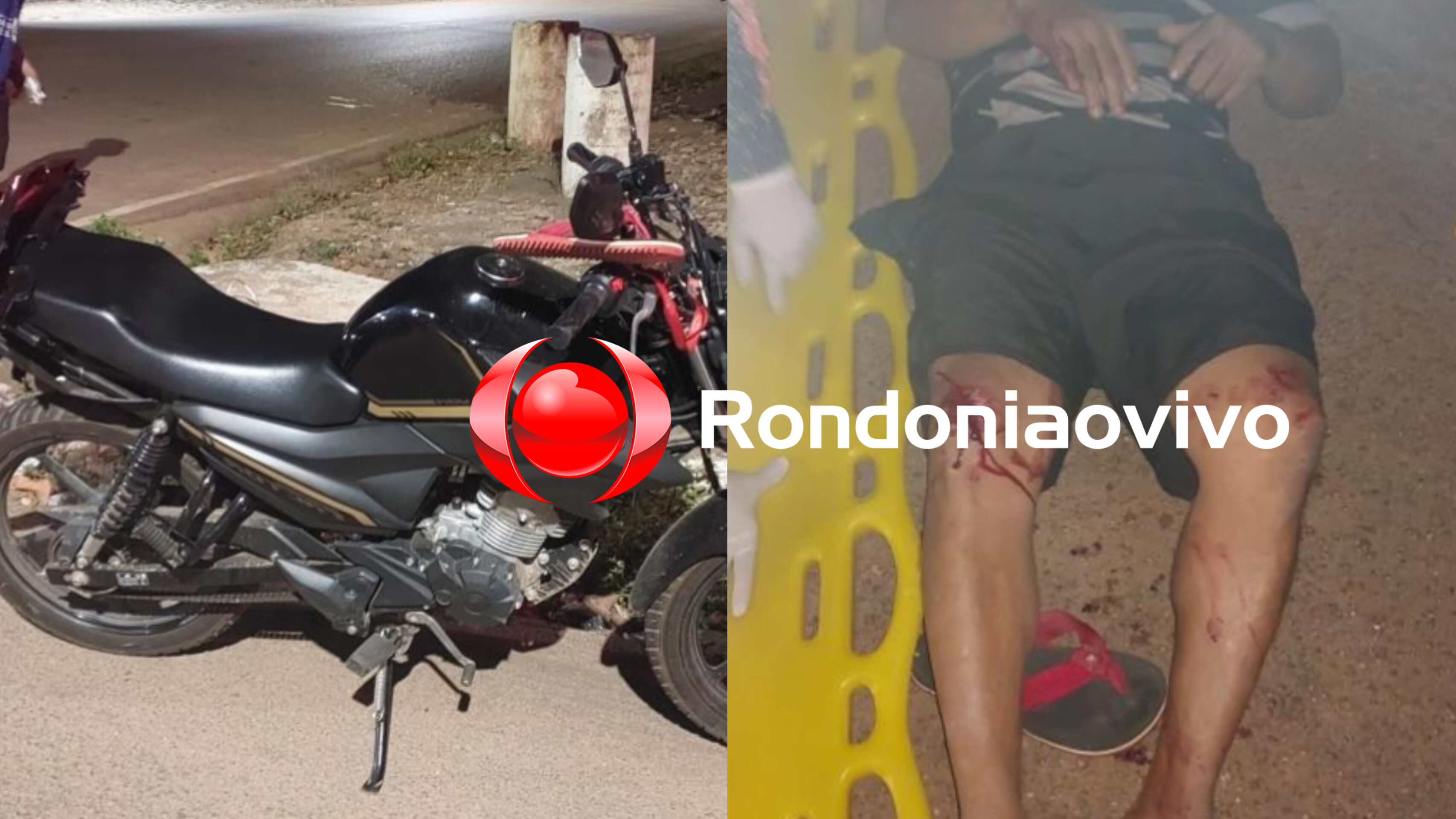 DESVIOU E CAIU: Motociclista sofre graves lesões após motorista de carro avançar preferencial 