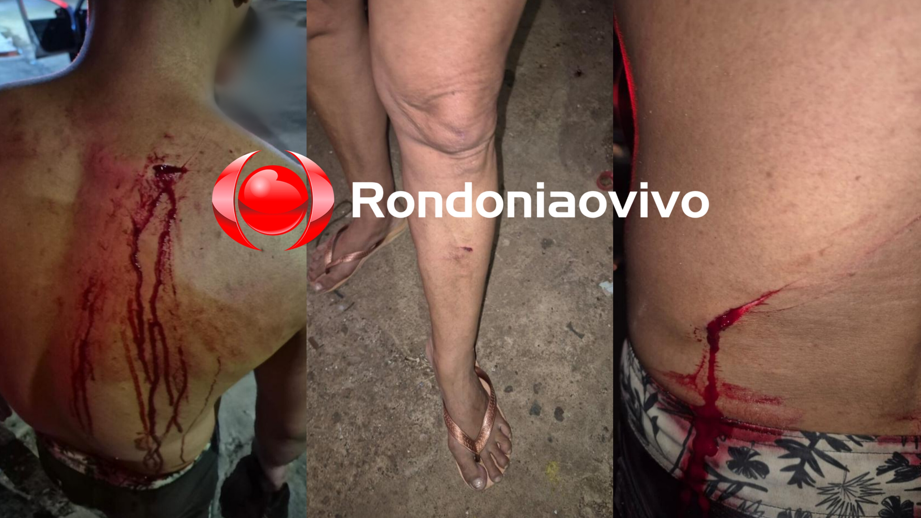 DESAVENÇA: Mãe e filho são agredidos por vizinho em vila de apartamentos