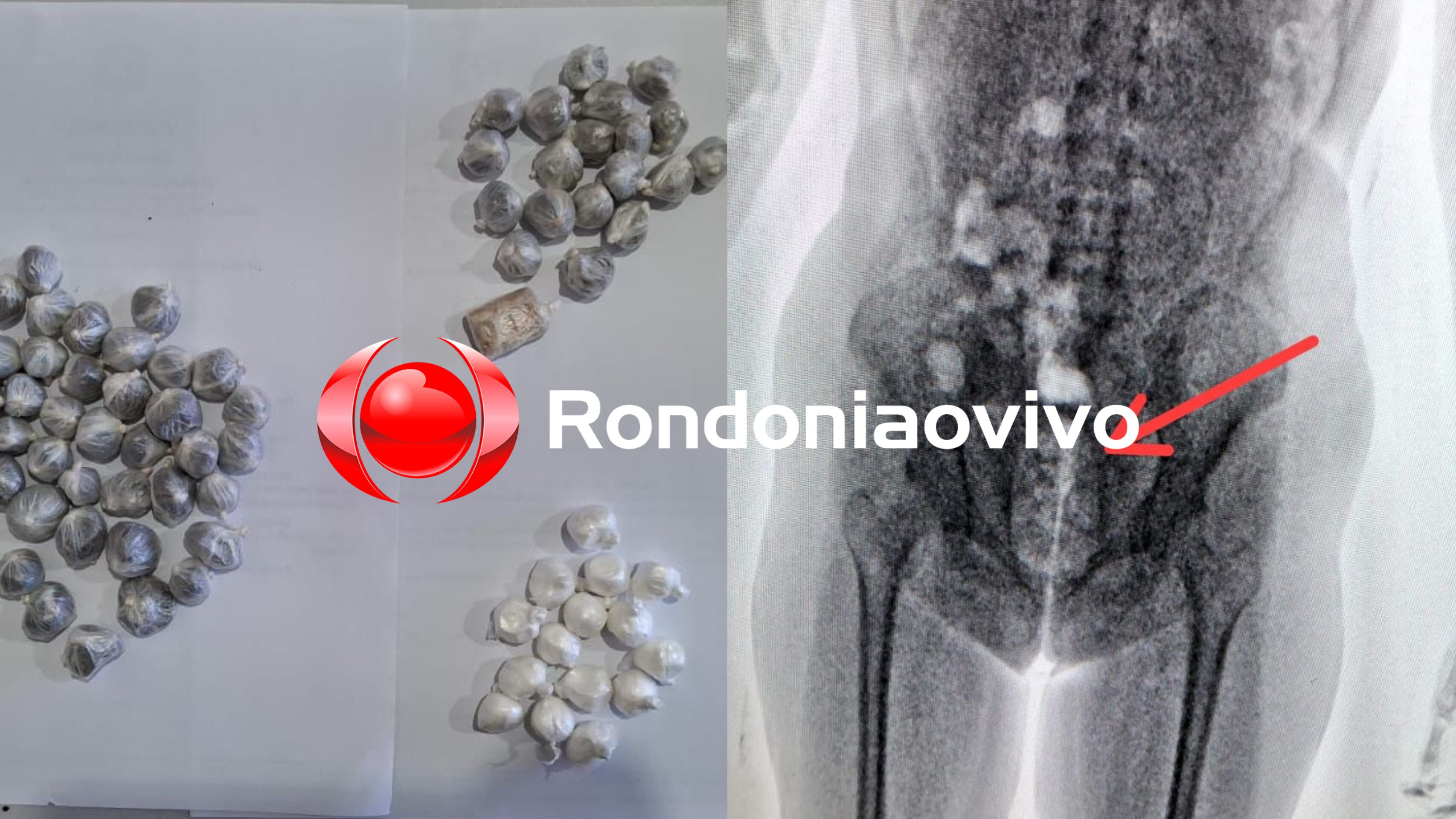 NO 470: Mulher é presa levando drogas no órgão genital para o marido 