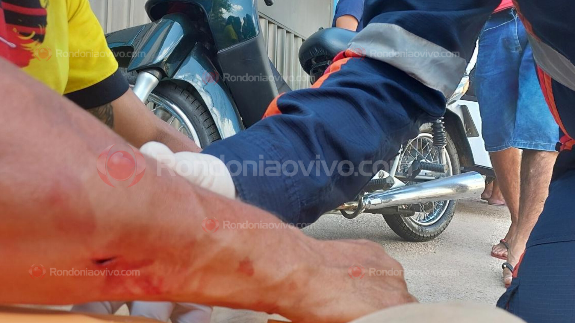 HOSPITALIZADO: Briga de bar termina em homem agredido com barra de ferro