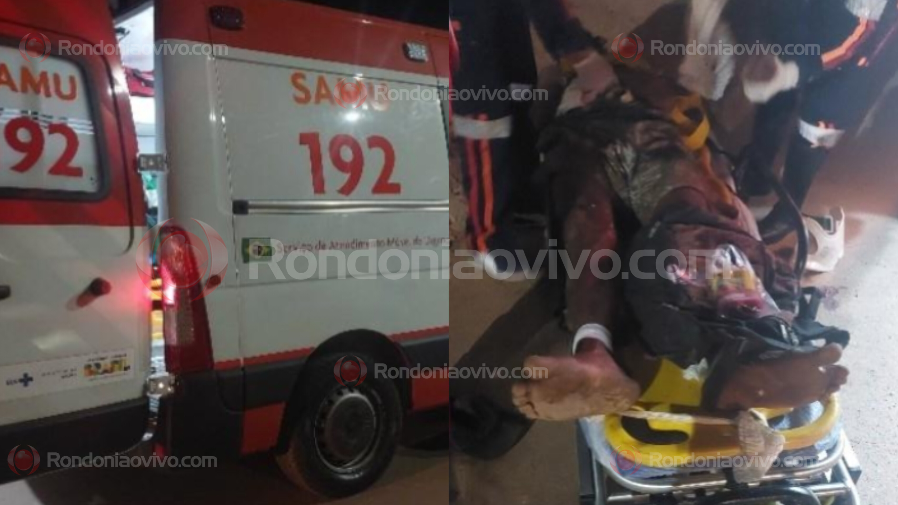 ESTADO GRAVE: Trio é acusado de agredir homem a pauladas no Jardim Santana 