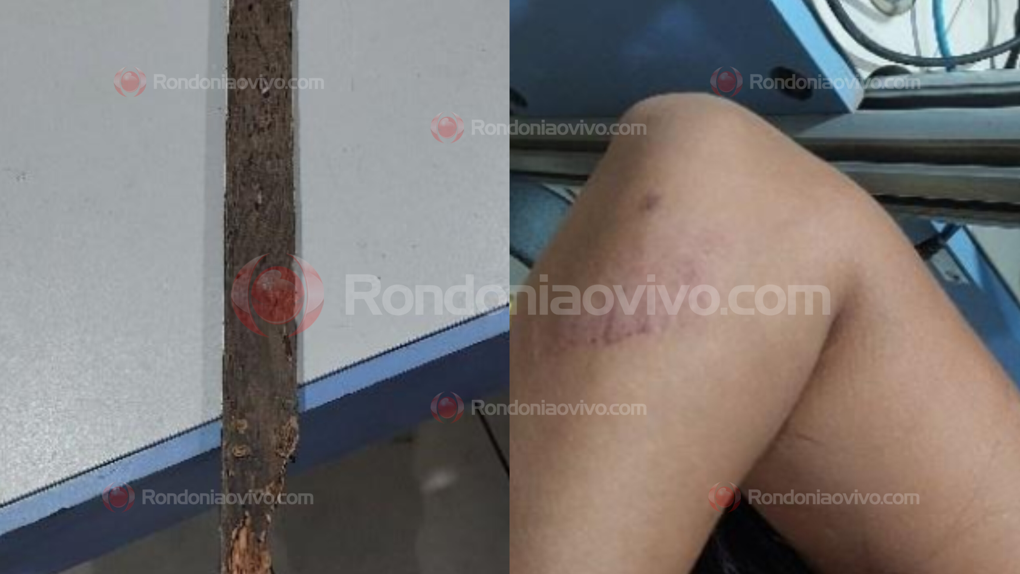 NO CENTRO: Mulher é atacada a pauladas pelo marido por querer comer peixe 