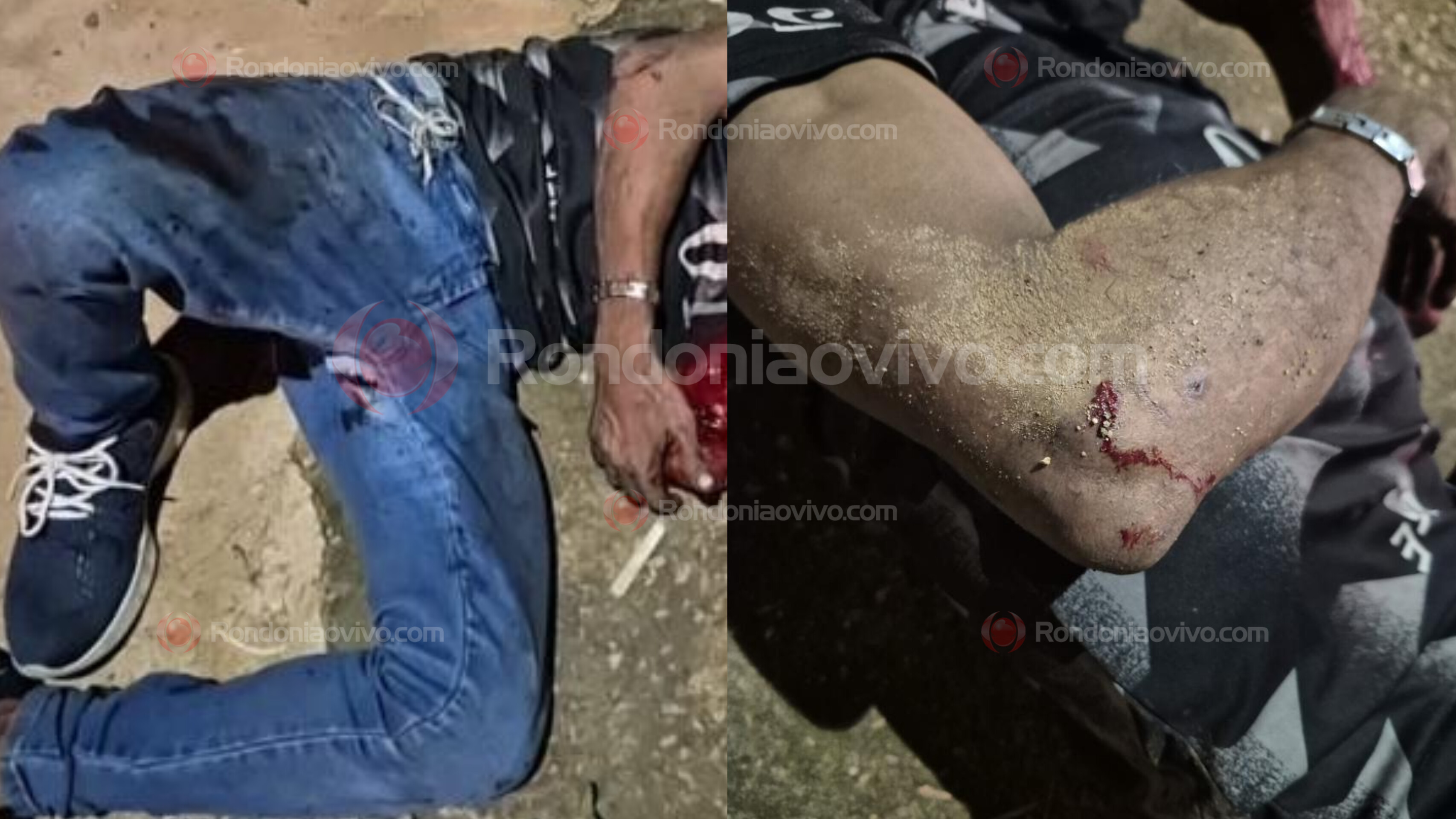 POPULAÇÃO PEGOU: Acusado de furto em residência é espancado e socorrido ao hospital JPII