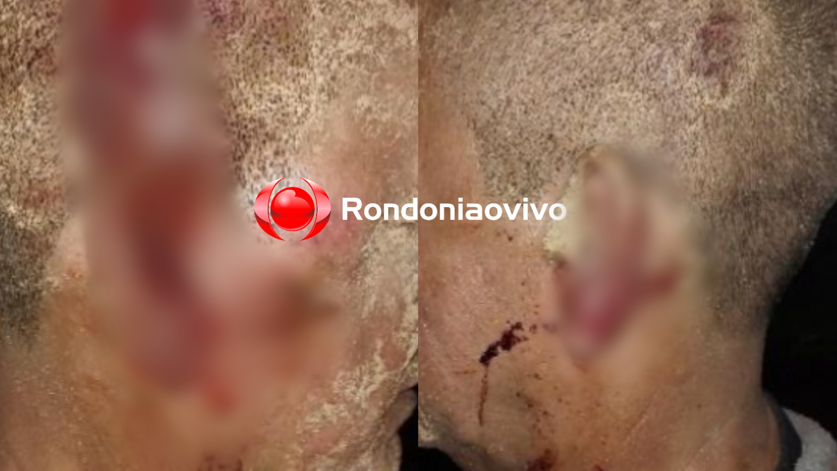 AMARRADO: Servidor público federal é atacado com pedrada e paulada durante roubo 