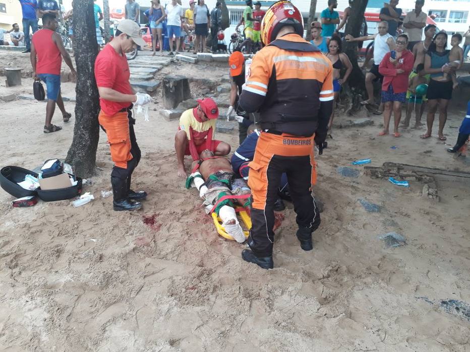 Turista atacado por tubarão tem perna amputada e corre risco de morte