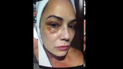 Ministério Público denuncia ex por agressão a Luiza Brunet
