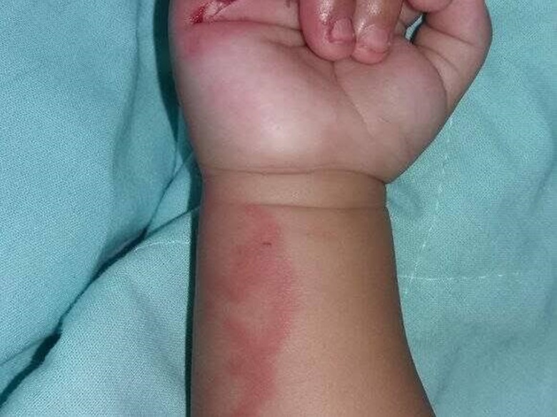 CRUELDADE: Mãe embriagada é presa por agredir bebê de três meses