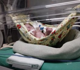 Redes e polvo terapia auxiliam no desenvolvimento de prematuros na UTI neonatal 