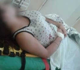 Garota atingida por disparo de arma policial dá detalhes sobre episódio