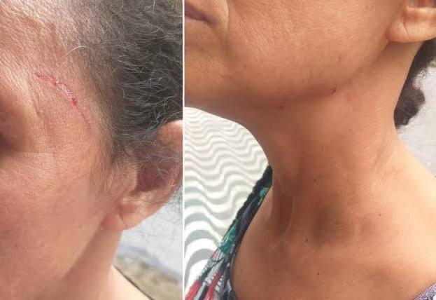 ALTERADO: Marido é preso após chegar em casa bêbado e espancar a mulher 