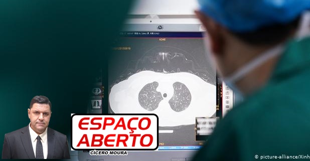 ESPAÇO ABERTO: Quem for infectado pelo novo coronavírus pode ficar com sequelas