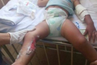 Mãe abandona filho em posto após tatuar criança e tentar remover desenho com produto químico