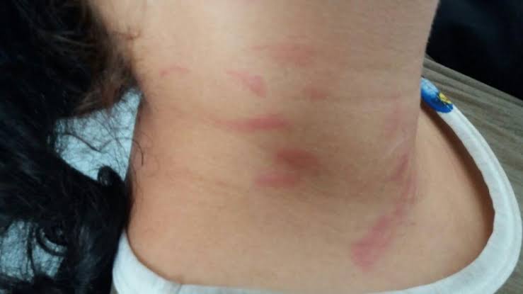 NEGOU SEXO: Marido joga fezes de cachorro em mulher durante agressão dentro de casa