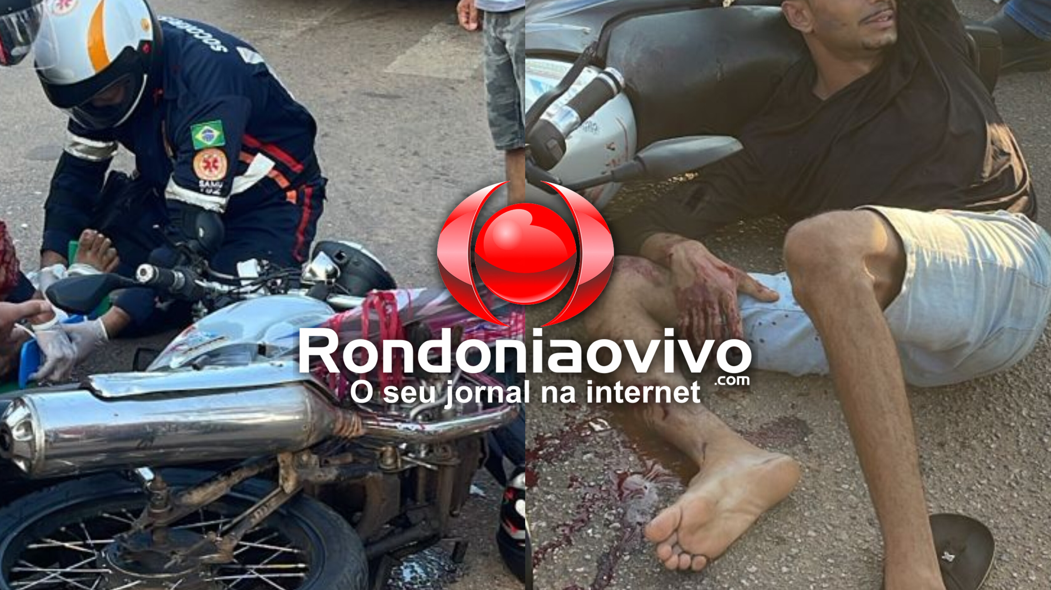 URGENTE: Motociclista tem fratura exposta após mulher fazer conversão proibida em semáforo