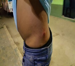 Jovem sofre tentativa de homicídio; amigo é baleado de raspão