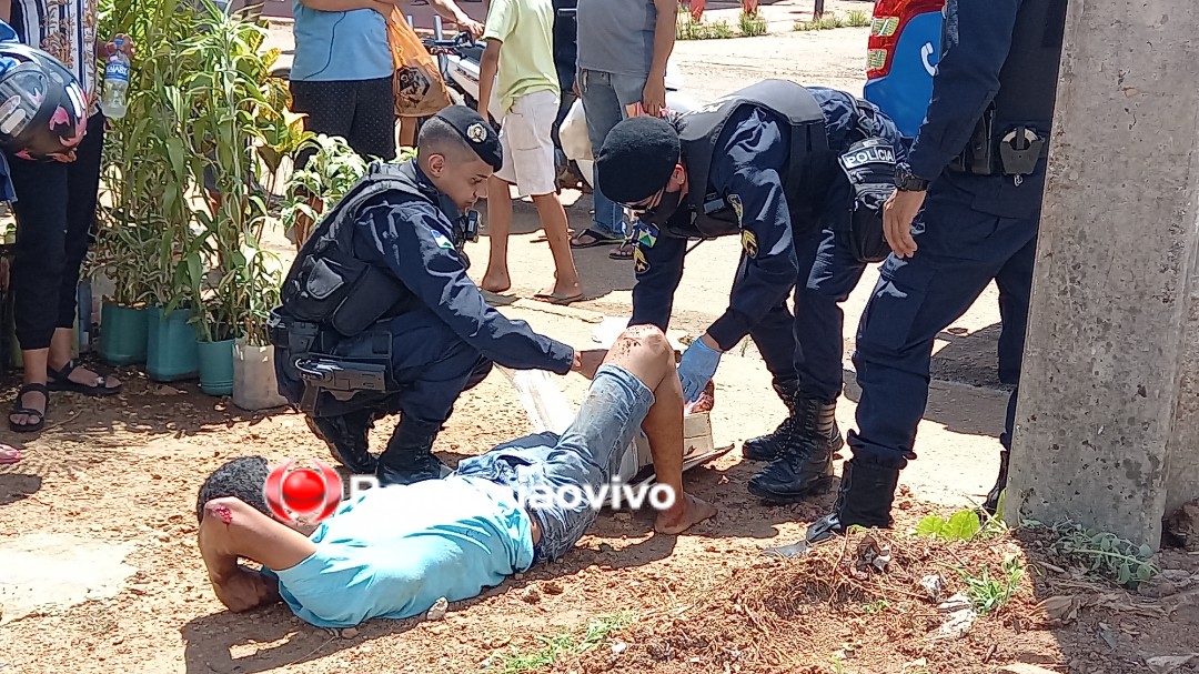 VÍDEO: Assaltante sofre fratura exposta na perna após roubo e acidente