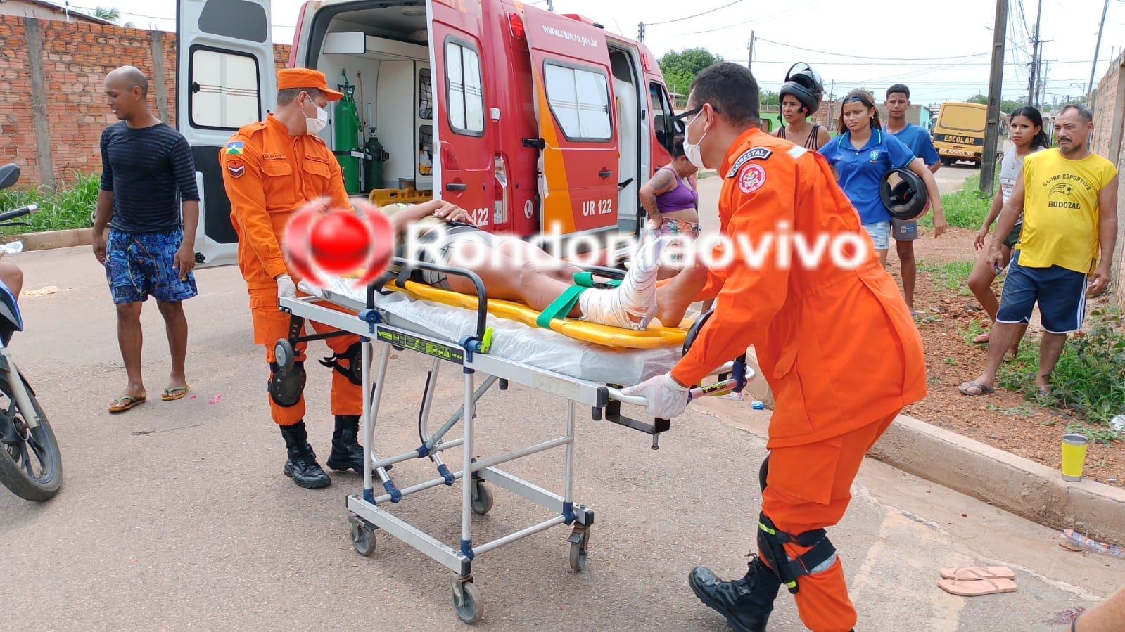 EXPOSTA: Mulher tem grave fratura após avançar a preferencial com motocicleta