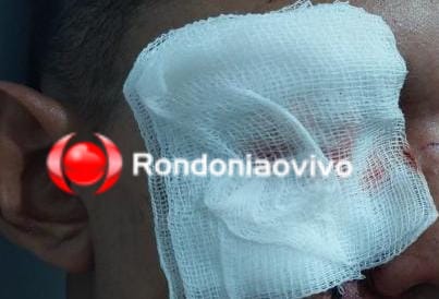 NO OLHO: Funcionário do IG é agredido por bandidos que usaram chave de roda como arma