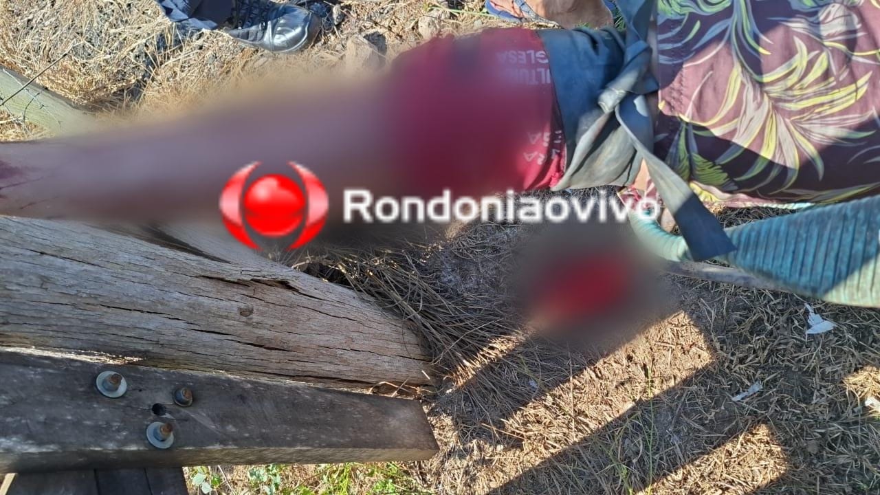 URGENTE: Trabalhador sofre grave corte na perna em acidente com motosserra