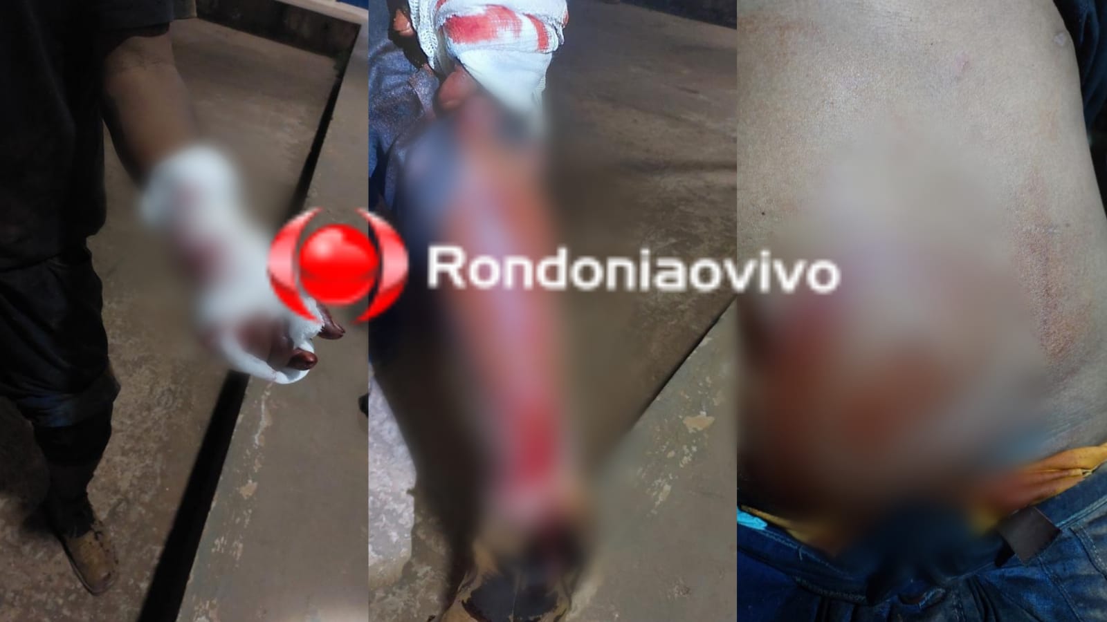 NO BAR: Homem sofre tentativa de homicídio e diz que foi por causa de mulher