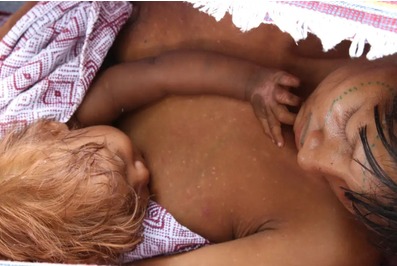 SAÚDE: MPF recomenda medidas contra a violência obstétrica de mulheres indígenas