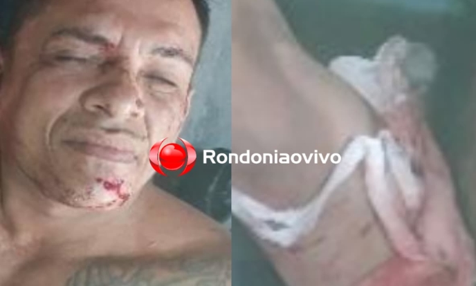 CASTIGADO: Pitbull ataca ladrão que invadiu residência para furtar bomba de poço 