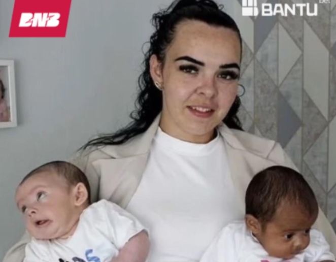 CASO RARO: Mulher tem gêmeos de pais diferentes e DNA comprovam fenômeno