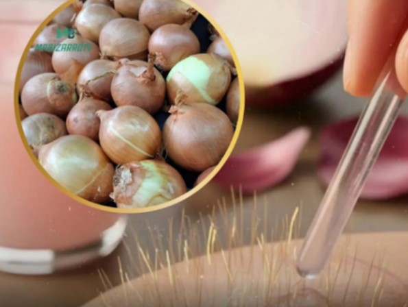 E O CHEIRO?: Suco de cebola no couro cabeludo pode restaurar cabelos em 86%