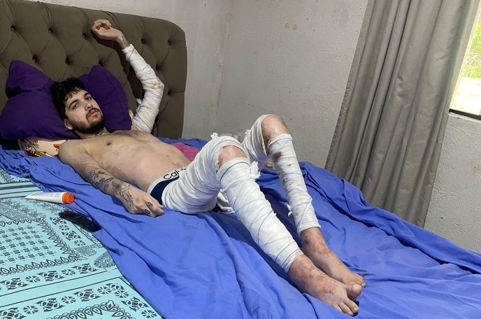 SOLIDARIEDADE: Jovem luta pela vida e pede ajuda em Rondônia