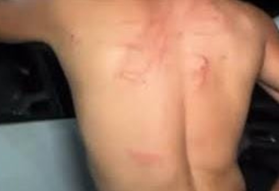 APANHOU: Marido aciona a PM após ser agredido pela esposa em condomínio