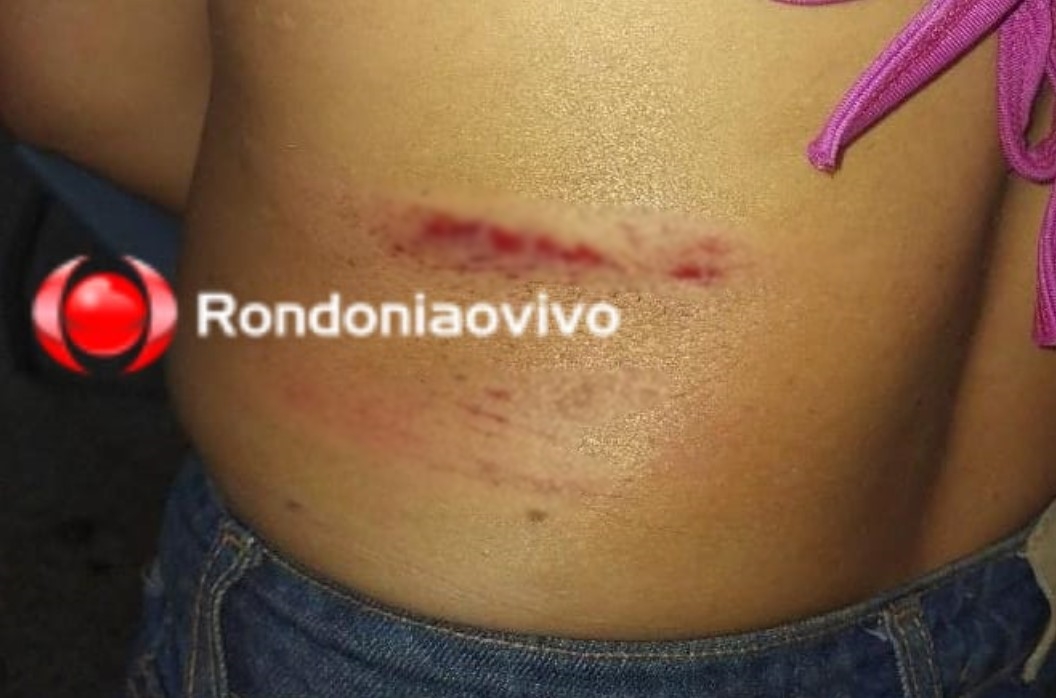 ALTERADO: Mulher é atacada a pauladas pelo sobrinho do marido e vai parar na UPA