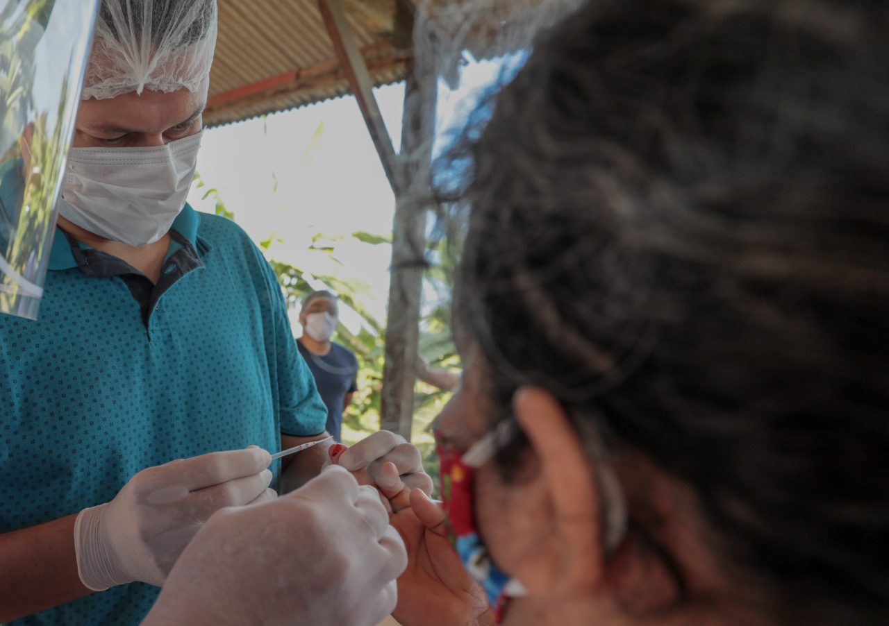 PANDEMIA: Profissionais orientam o momento mais adequado para fazer o teste da Covid-19