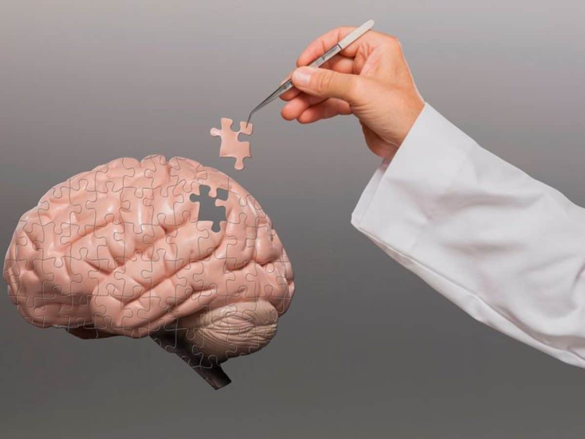 SAÚDE E BEM ESTAR: Alzheimer causas e tratamentos na busca por respostas
