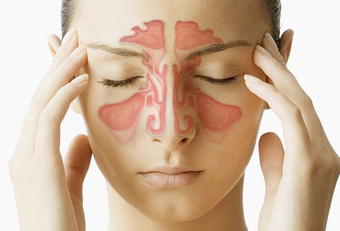 SAÚDE E BEM ESTAR: Conheça as principais causas, sintomas e tratamentos da sinusite