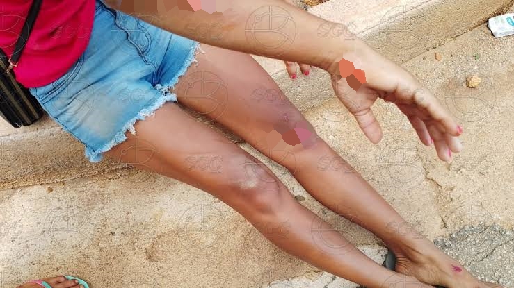 ROUBO: Mulher é derrubada de motocicleta por assaltante na zona Sul 