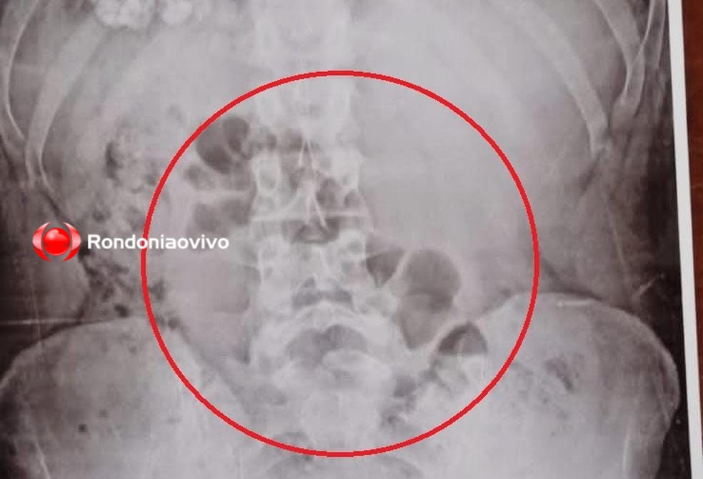 URGENTE: Mãe é flagrada com drogas no estômago levando para o filho no 603