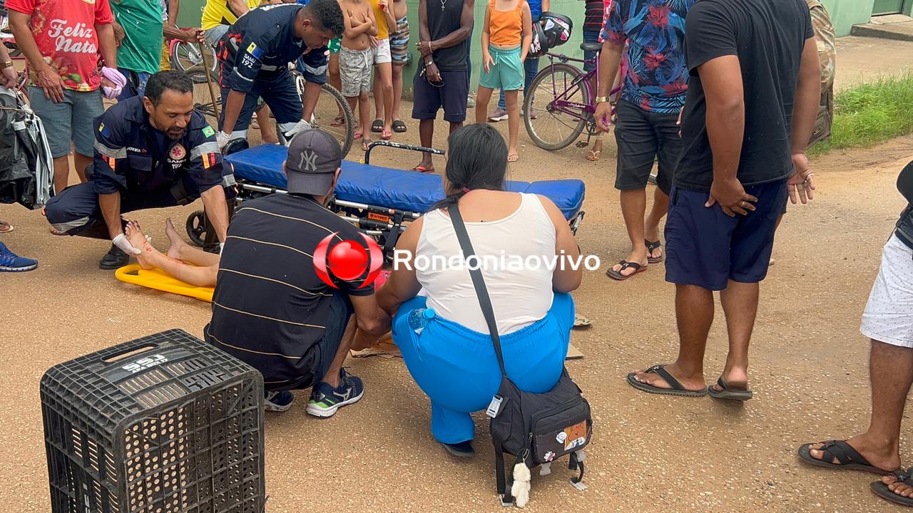 URGENTE: Criança sofre fratura exposta em atropelamento na União