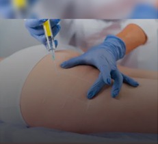 CONTORNO CORPORAL: Clínicas passam a usar gordura de cadáveres para aumento de glúteos 