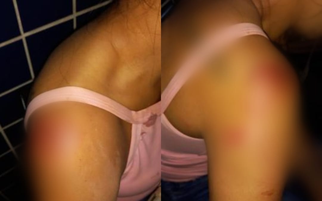 NO IGARAPÉ: Jovem é agredida e expulsa de casa pelo marido; PM agiu rápido