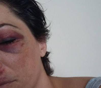 MARIA DA PENHA: Ao dizer que voltava de bar, mulher é agredida com socos no rosto pelo ex-marido