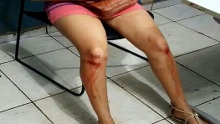 COVARDIA: Mulher é espancada e arrastada pelos cabelos na rua pelo ex-marido