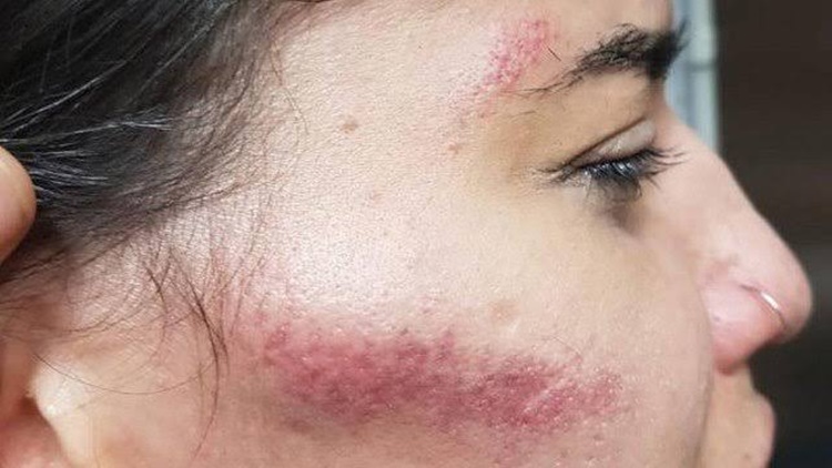 COVARDIA: Marido foge após agredir esposa a pauladas durante discussão