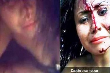 Adolescente capota carro a 180km/h e, em vez de pedir ajuda, tira selfies - FOTOS